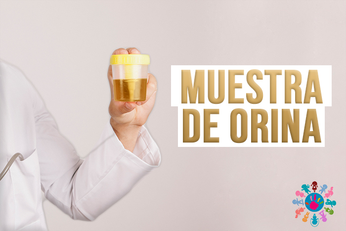 como-recolectar-muestra-de-orina